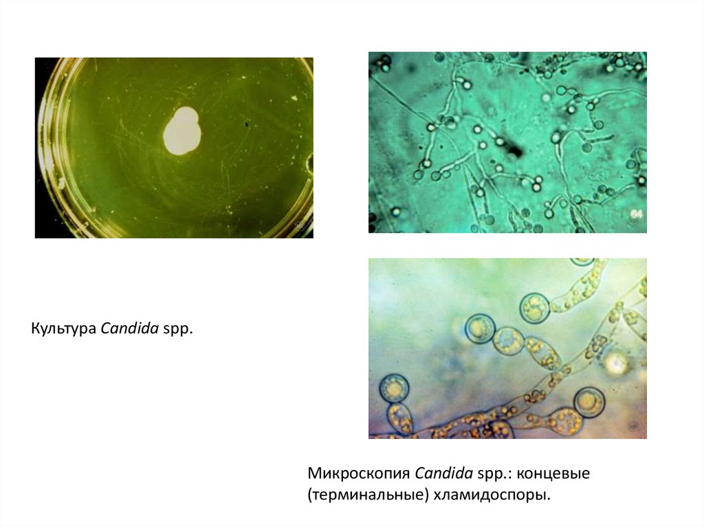 Candida spp. Кандида микроскопия. Грибы кандида под микроскопом. Хламидоспоры микроскопия. Микология в дерматологии.