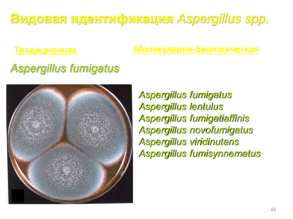 Аспергиллез микробиология презентация