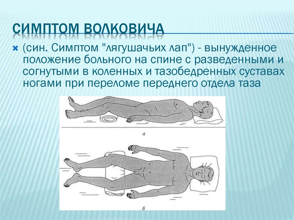 Травма лягушки. Положение лягушки при переломе таза. Положение лягушки при переломе костей таза. Положение лягушки при переломе костей. Поза лягушки при переломе таза.