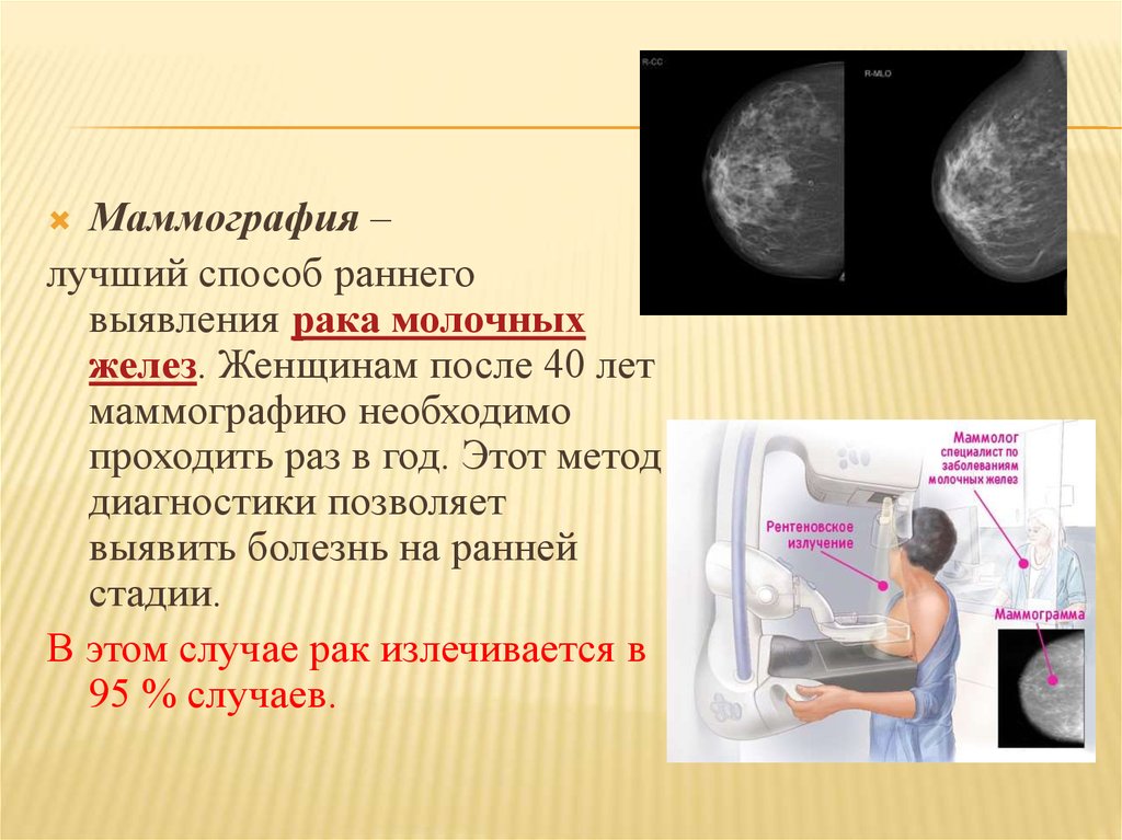 Сколько раз можно маммографию