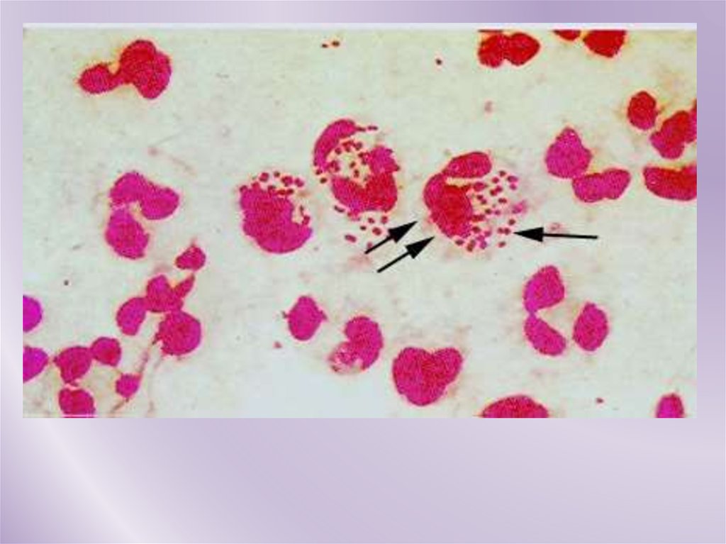 Chlamydia trachomatis neisseria gonorrhoeae. Нейссерия гонорея микробиология. Нейссерия гонорея по Граму. Гонорея мазок микроскопия.