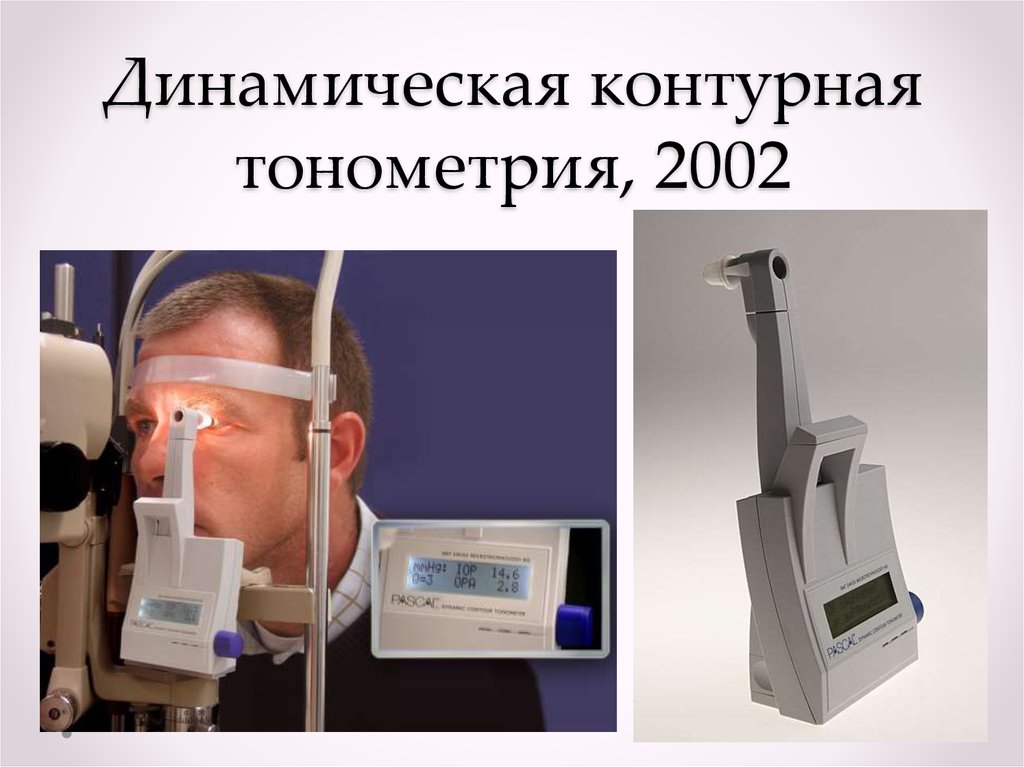 Тонометрия. Динамическая контурная тонометрия. Аппланационный тонометр Гольдмана. Динамическая контурная тонометрия (тонометр Паскаля).. Приборы для офтальмотонометрии.