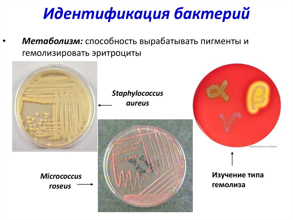 Идентификация бактерий