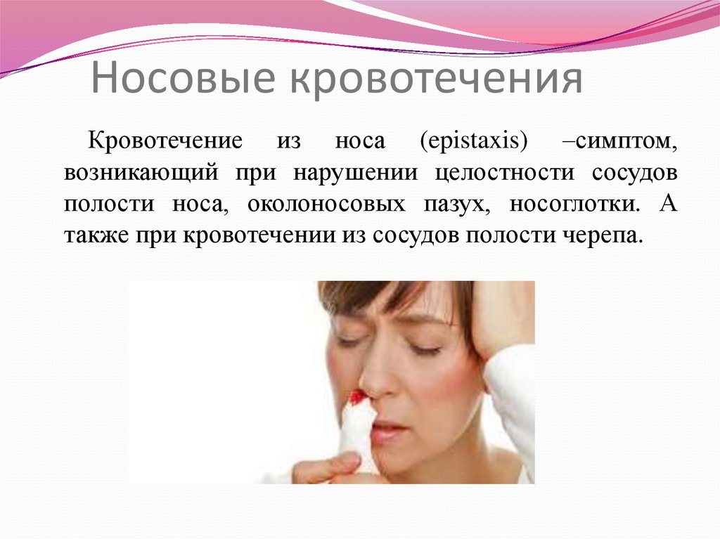 При носовом кровотечении выполняют. Носовое кровотечение характеристика. Симптомы носового кровотечения. Нососовое кровотечение. Симптомы нового кровотечения.
