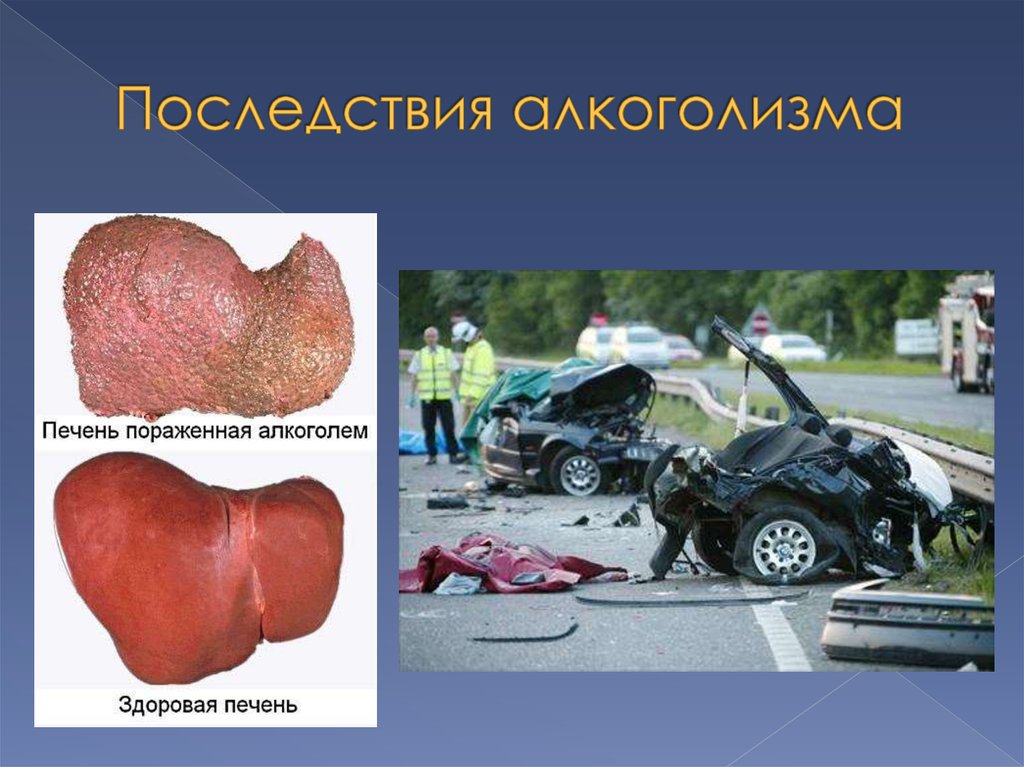 Последствия алкоголизма