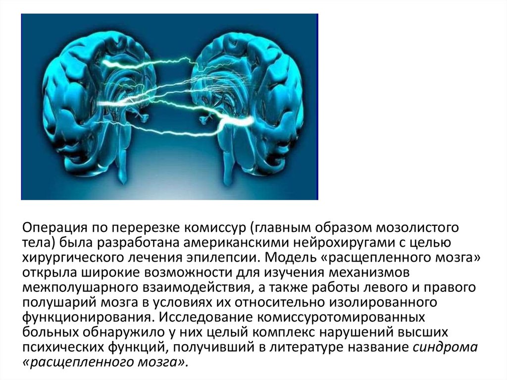 Рассечение мозолистого тела