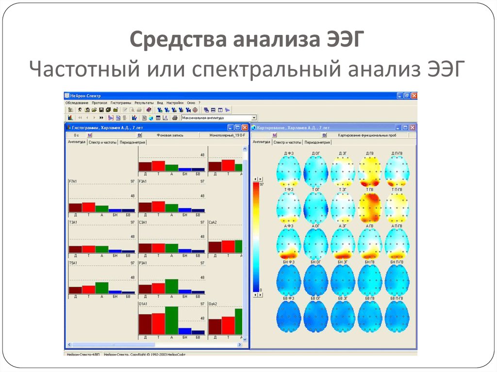 Препарат анализа