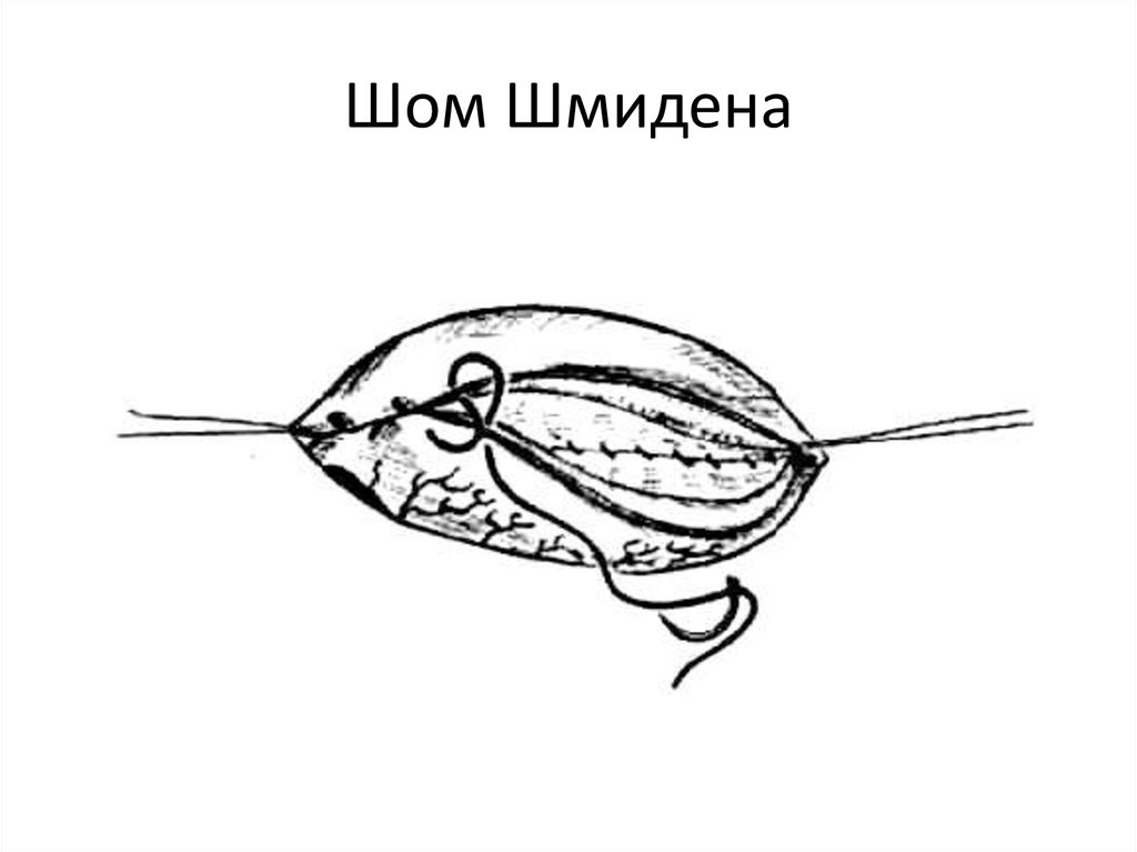 Шом Шмидена