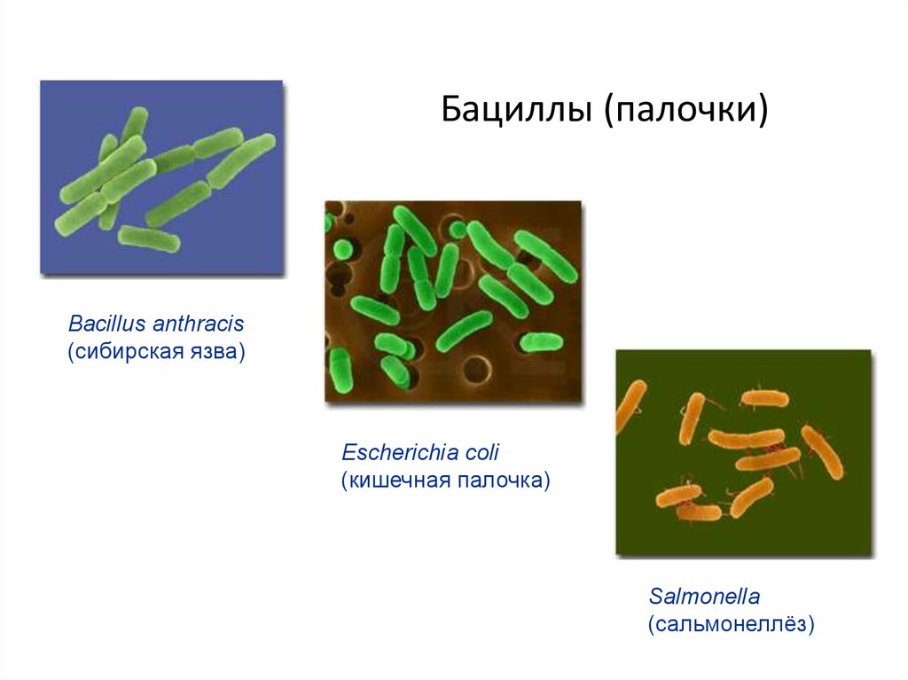 Палочковидные бактерии. Палочковидные бактерии (палочки).. Палочки бактерии бациллы. Сообщение о бактерии бацилла. Биология 5 класс сообщение о бактерии бациллы.