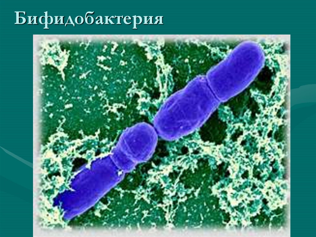 Бифидобактерии. Бифидобактерии лонгум. Бифидобактерии в микроскопе. Бифидобактерия форма бактерии. Бифидобактерии и энтерококки.