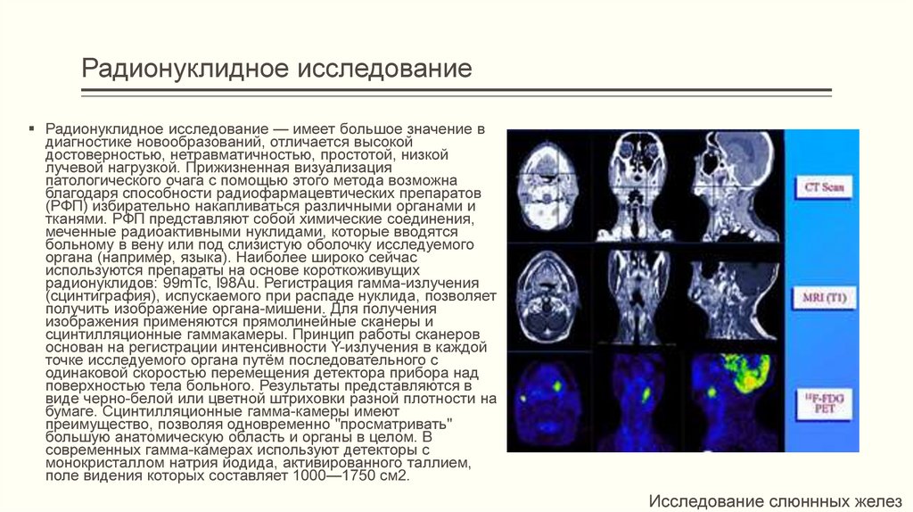 Диагностика новообразований челюстно лицевой области презентация