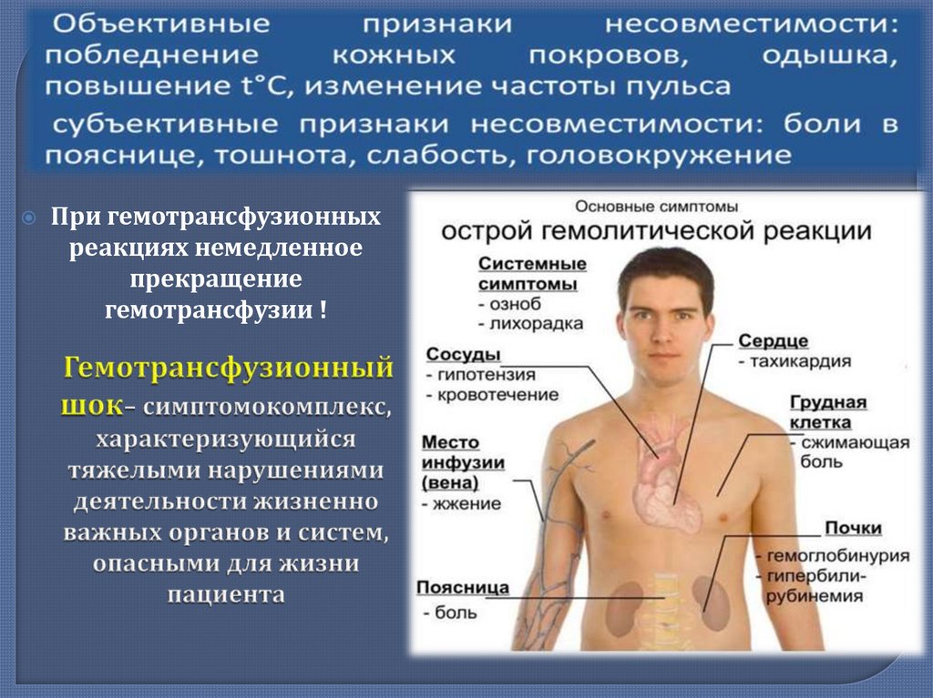 Гемотрансфузионный шок презентация