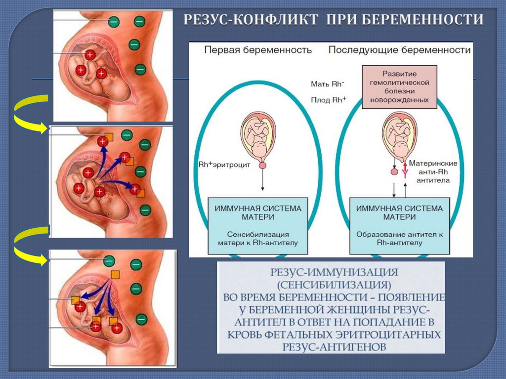 Отрицательный резус беременности последствия. Схема резус конфликта матери и ребенка. Последовательность стадий развития резус- конфликта. Иммунный механизм резус конфликта. Механизм возникновения резус конфликта матери и плода.