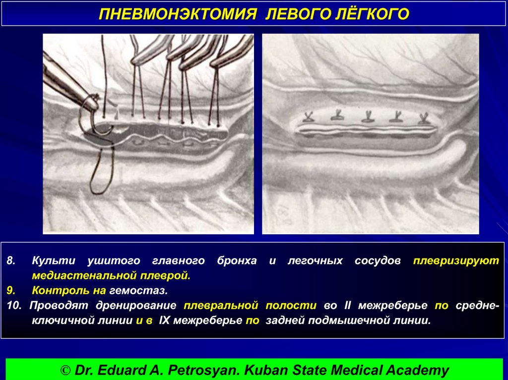 На шарнире укреплен конец легкого рычага к которому прикреплена гиря массой 2 кг