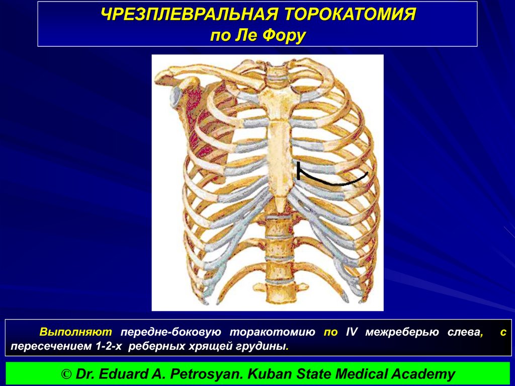 хрящи ребер. хрящ в грудной клетке. кости грудной клетки анатомия. хрящ в грудной клетке. хрящи грудной клетки.