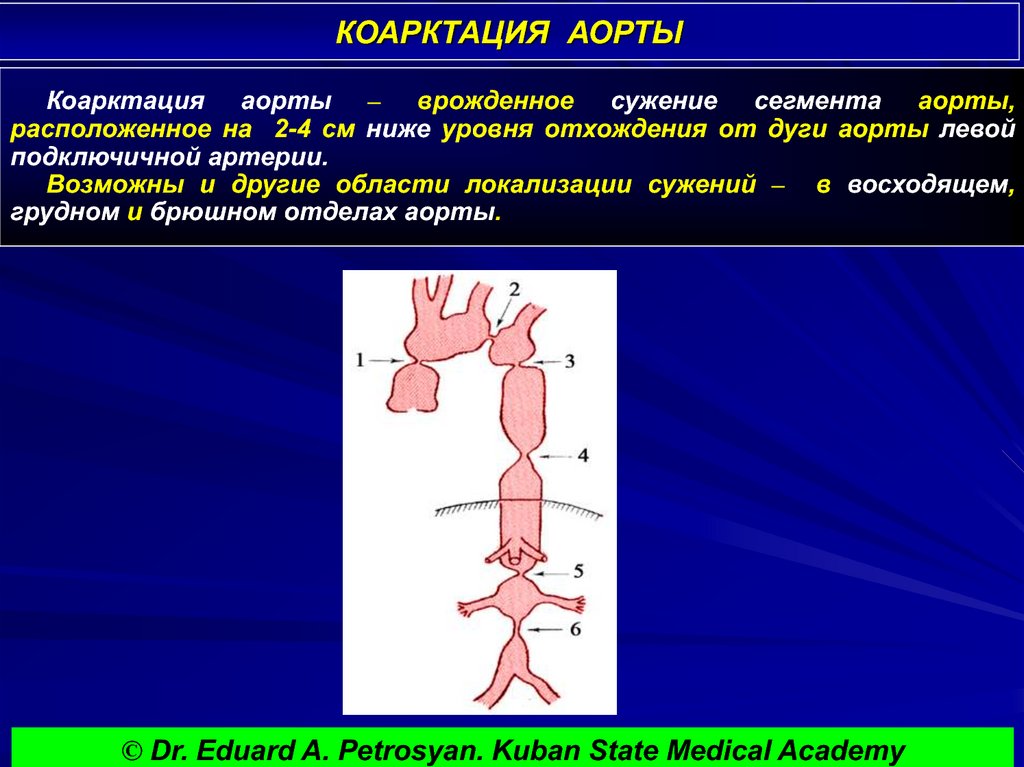 Аорта клинические рекомендации