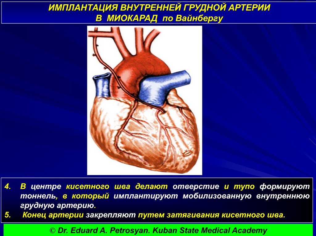 Можно ли выжить после ранения в сердце