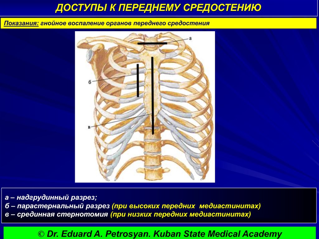 ДОСТУПЫ К ПЕРЕДНЕМУ СРЕДОСТЕНИЮ