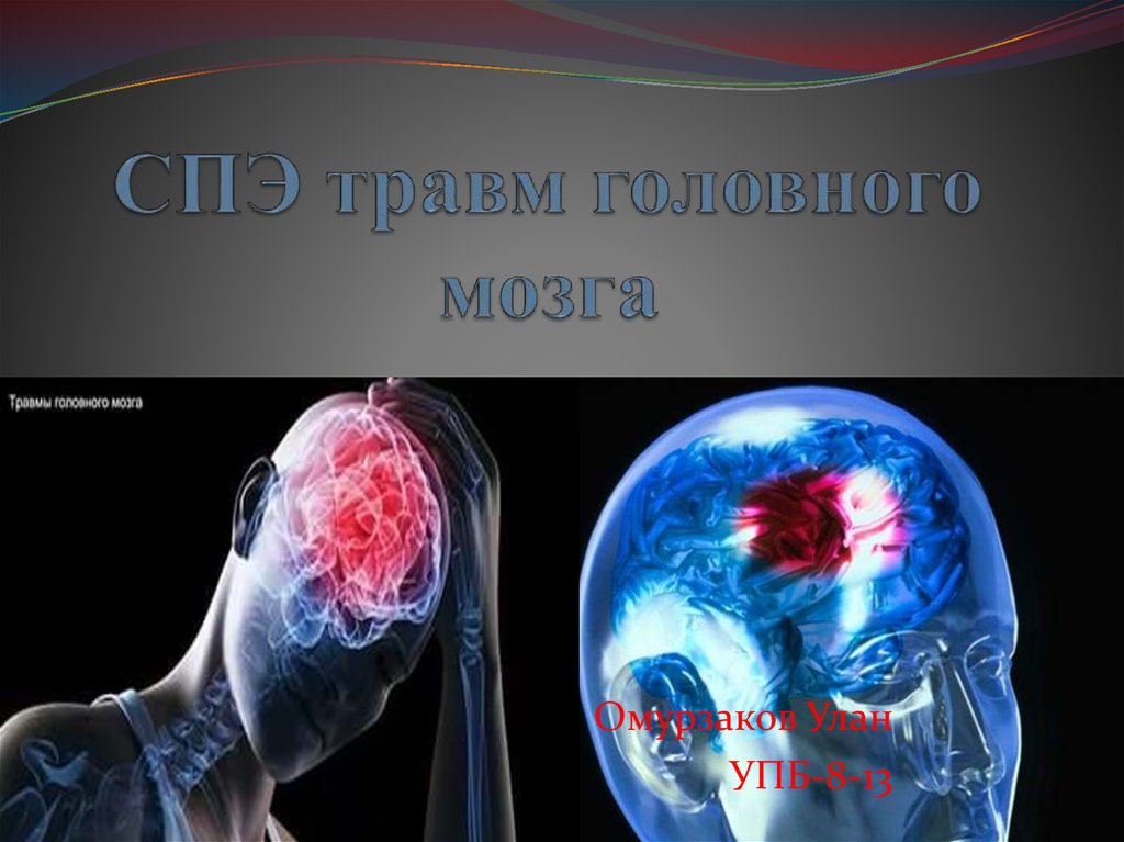 Мозг поврежден. Ушиб головного мозга презентации. Травмы головного мозга презентация. Повреждения головного мозга презентация. Судебно психиатрическая экспертиза повреждение головного мозга.