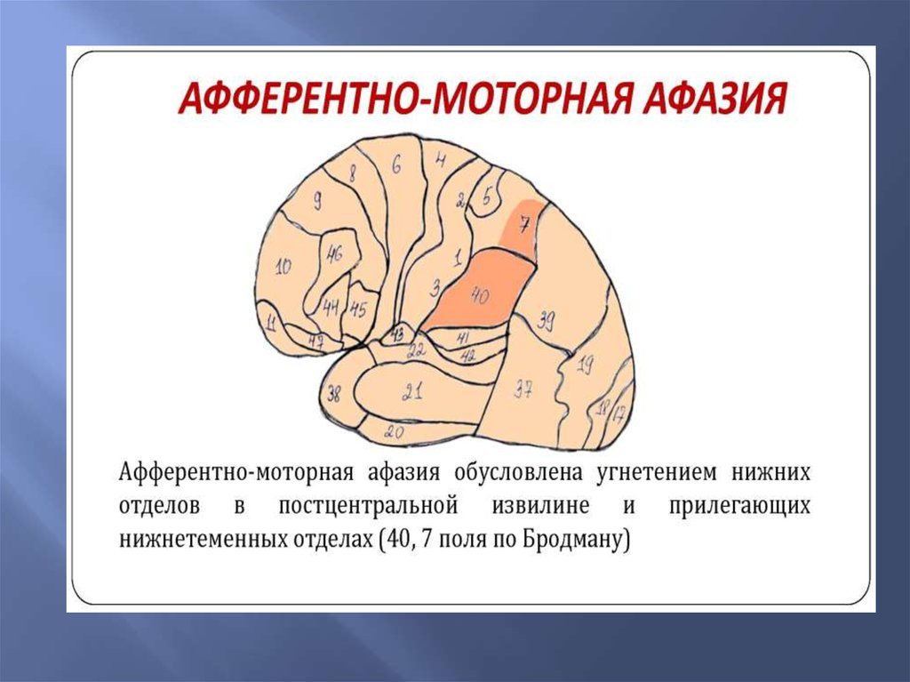 Афферентная и эфферентная моторная афазия