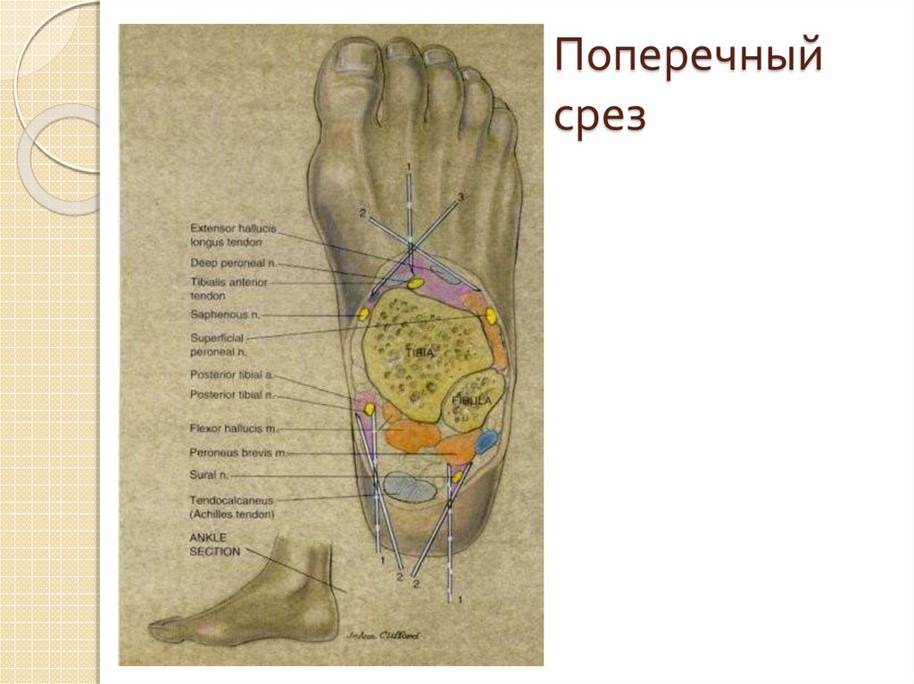 Поперечный срез