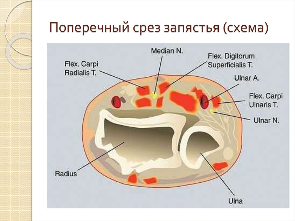 На ладони выделяют фасциальные ложа. Поперечный срез запястья. Поперечный распил кисти. Поперечный срез руки. Поперечный срез ладони топографическая анатомия.