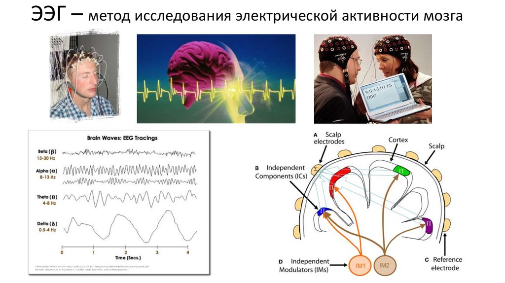 Регистрация активности мозга. Электрическая активность мозга. Исследование активности мозга. Методы исследования электрической активности мозга. Изучение головного мозга.