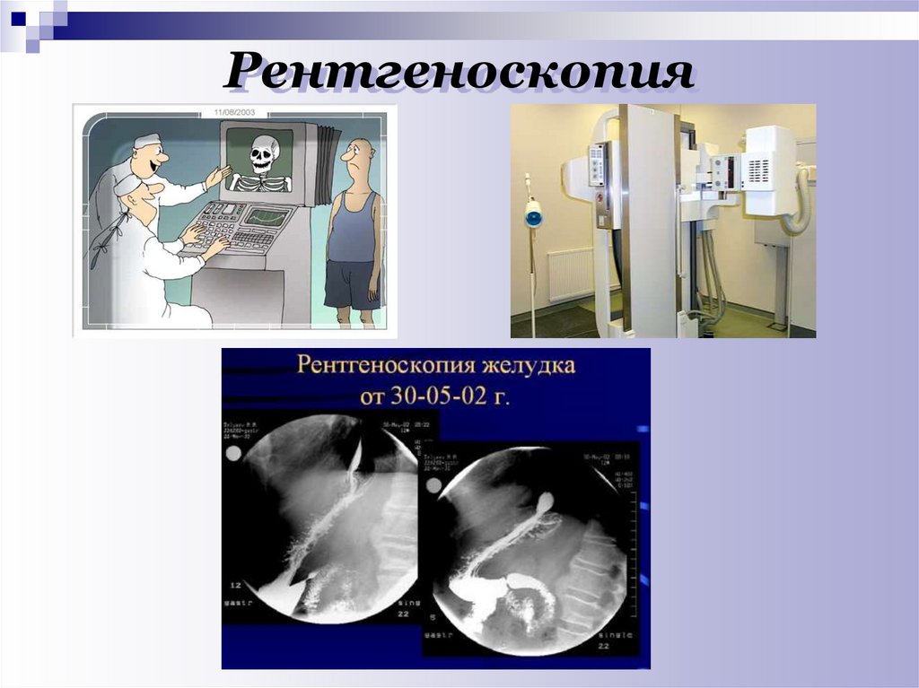 При рентгеноскопии изображение получается