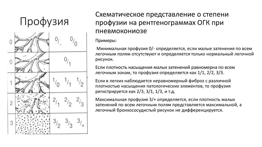 Уплотнен бронхососудистого рисунка