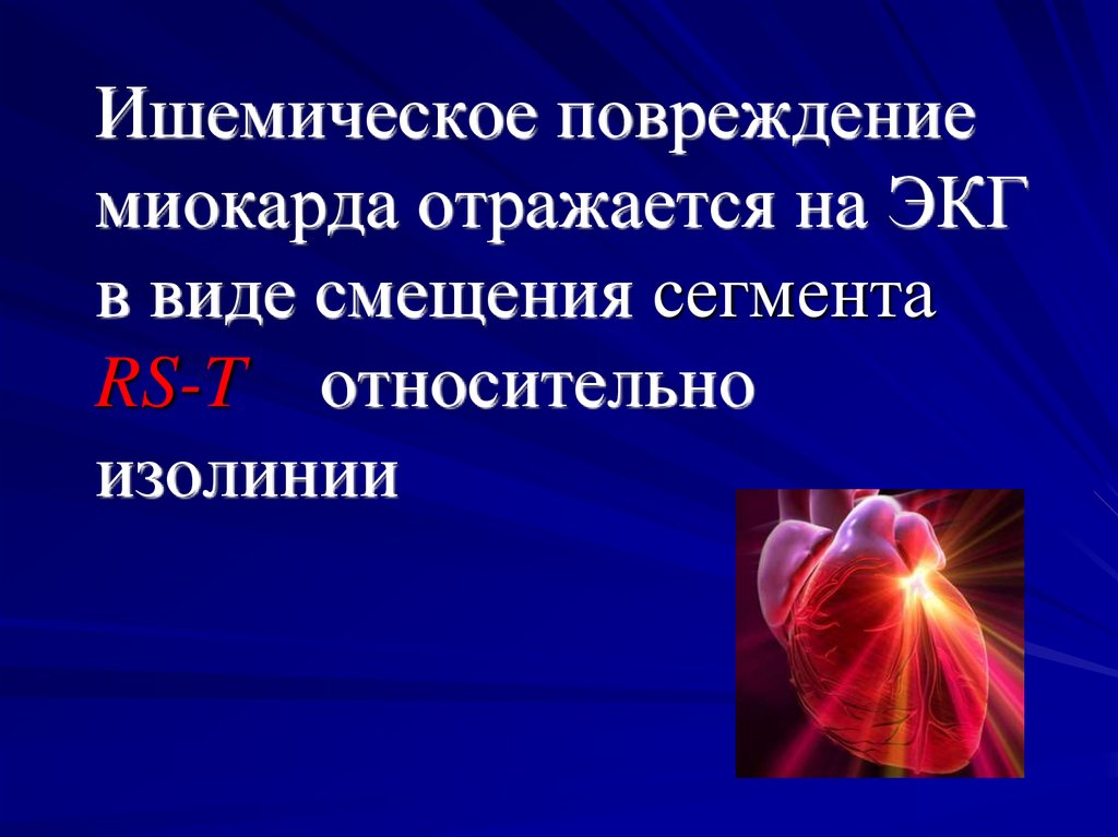 Разрыв миокарда. Ишемическое повреждение миокарда. Ишемическое повреждение миокарда патофизиология. Причины ишемического повреждения миокарда.