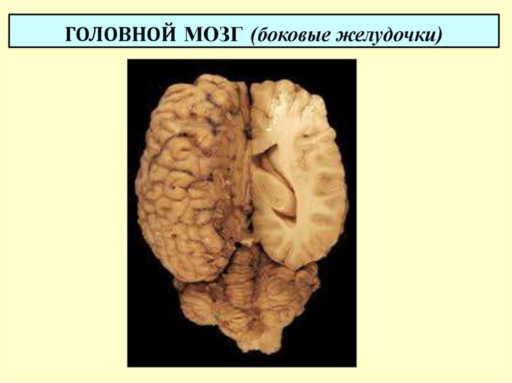 Боковой мозг. Боковые желудочки головного мозга. Боковые желудочки конечного мозга. Боковые желудочки мозга анатомия. Латеральные желудочки головного мозга.