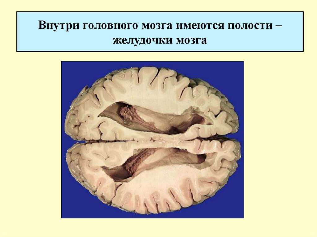Полости мозга заполнены. Полости головного мозга. Полости головного мозга желудочки. Желудочки внутри мозга.