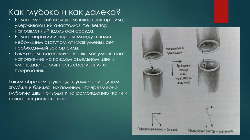 Более глубок. Как глубоко. Ось сосуда. Главные оси сосуда.