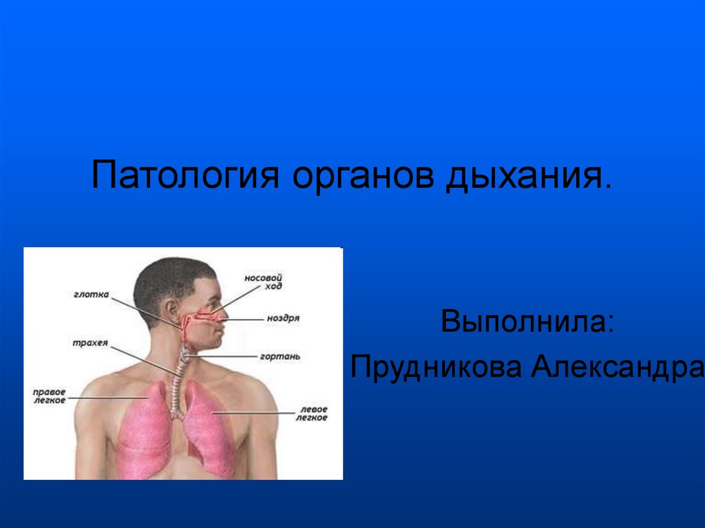 Патология органов. Патология органов дыхания. Патология системы дыхания. Возможные отклонения при патологии дыхательной системы. Аномалии органов дыхания.