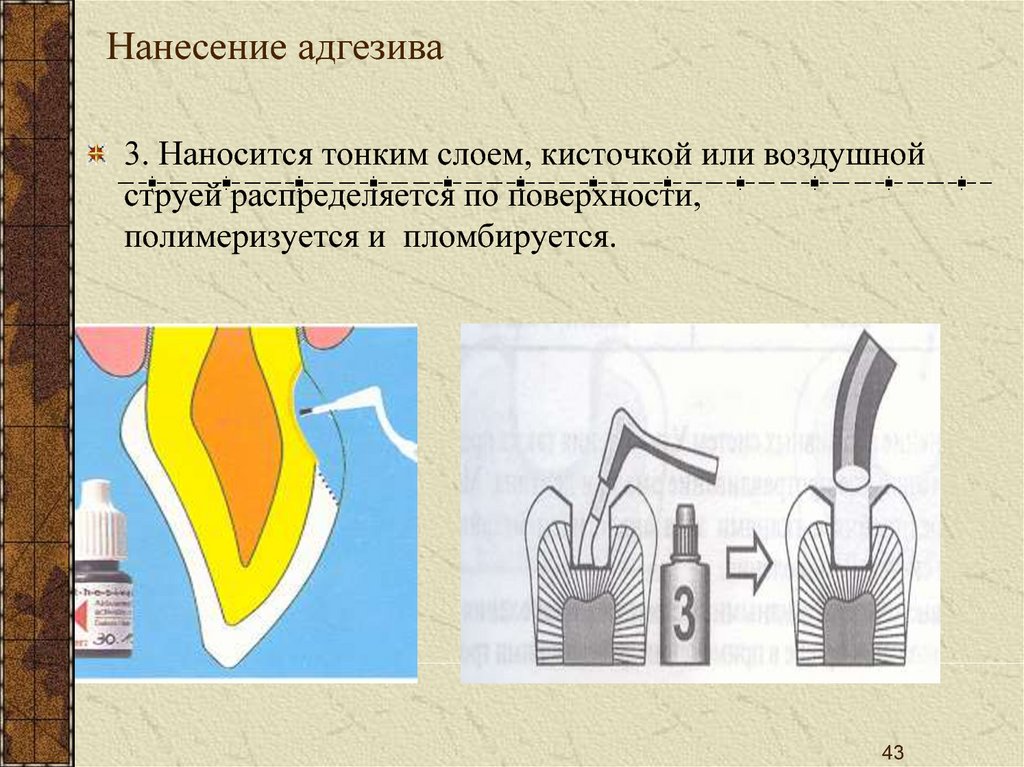 Адгезивы и герметики для восстановительной и профилактической стоматологии презентация