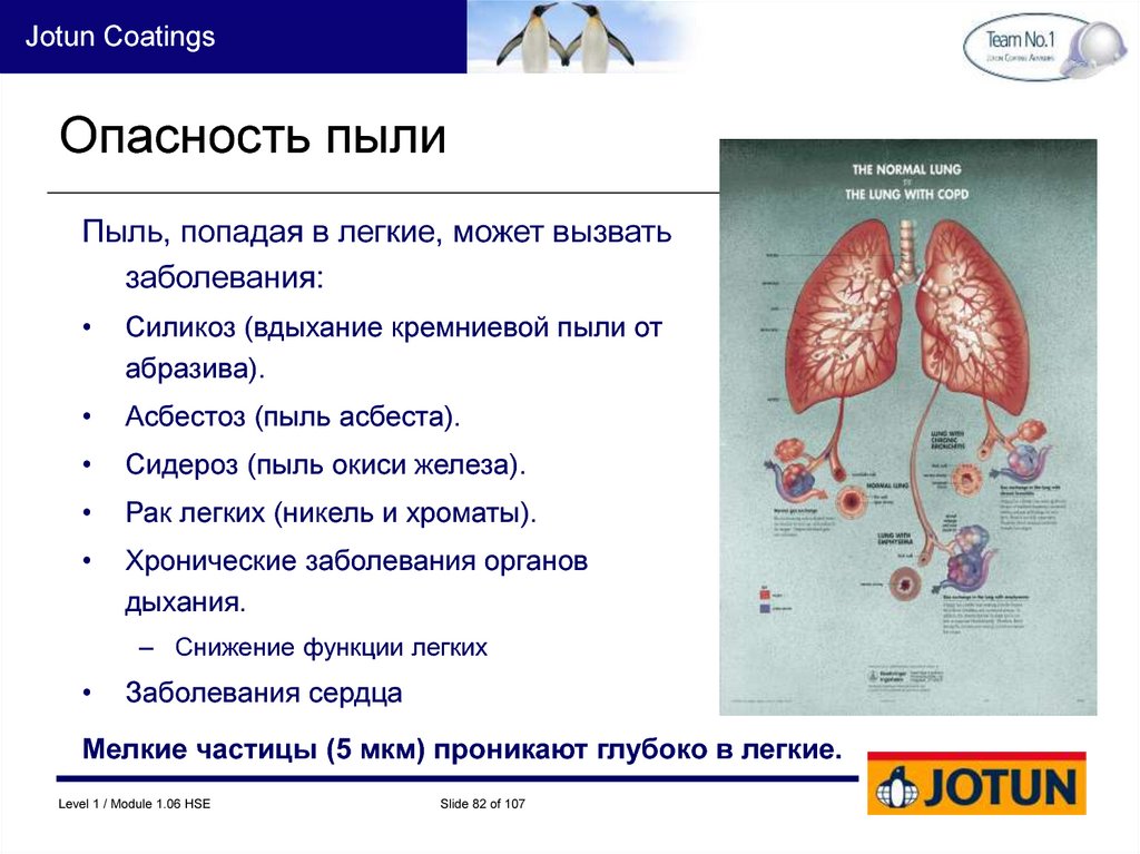 Попало в легкое. Попадание пыли в легкие. Пыль в легких чем опасна.