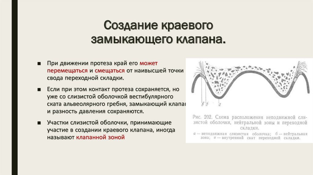 Методы фиксации и стабилизации съемных протезов при полном отсутствии зубов презентация