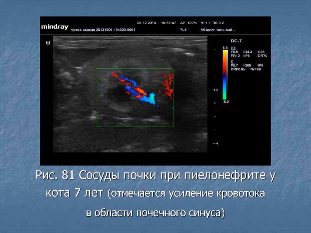 Кровоток усилен что это значит. Основы УЗИ диагностики. Почечный синус на УЗИ. Доплерография. Стандарты ультразвуковых исследований.