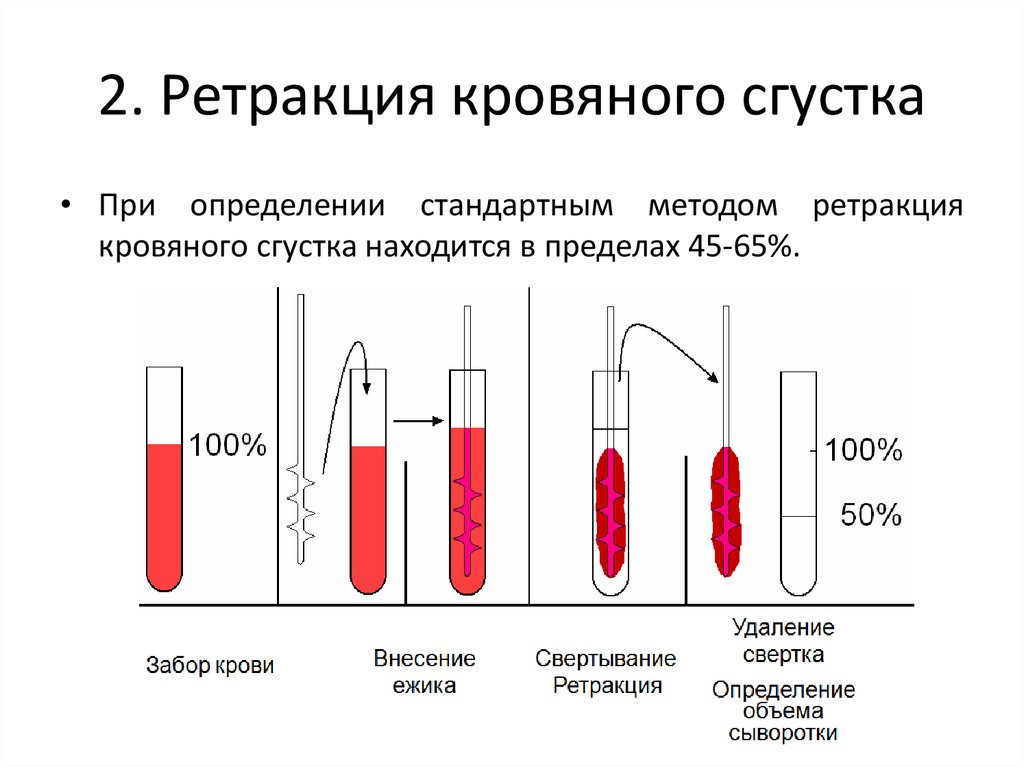 Ретракция. Механизм ретракции кровяного сгустка. Норма ретракции кровяного сгустка. Реакция кровяного сгустка норма. Оценка ретракции кровяного сгустка методика.