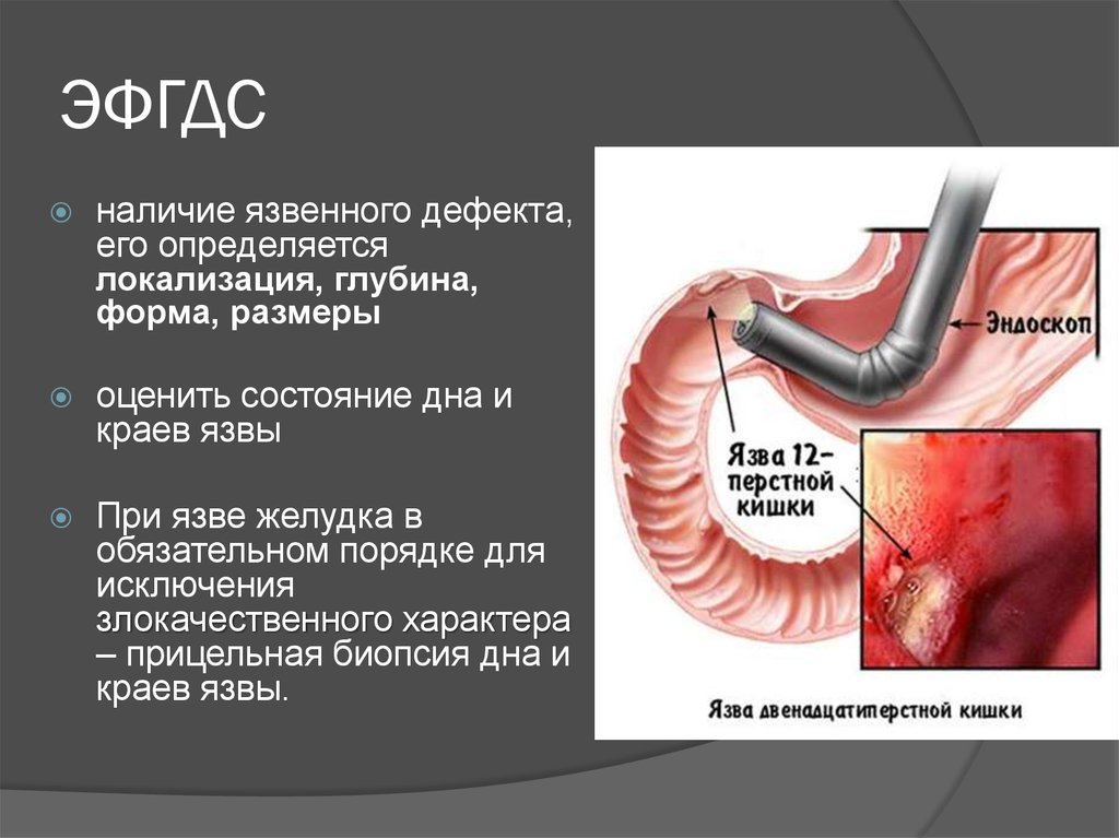 ЭФГДС