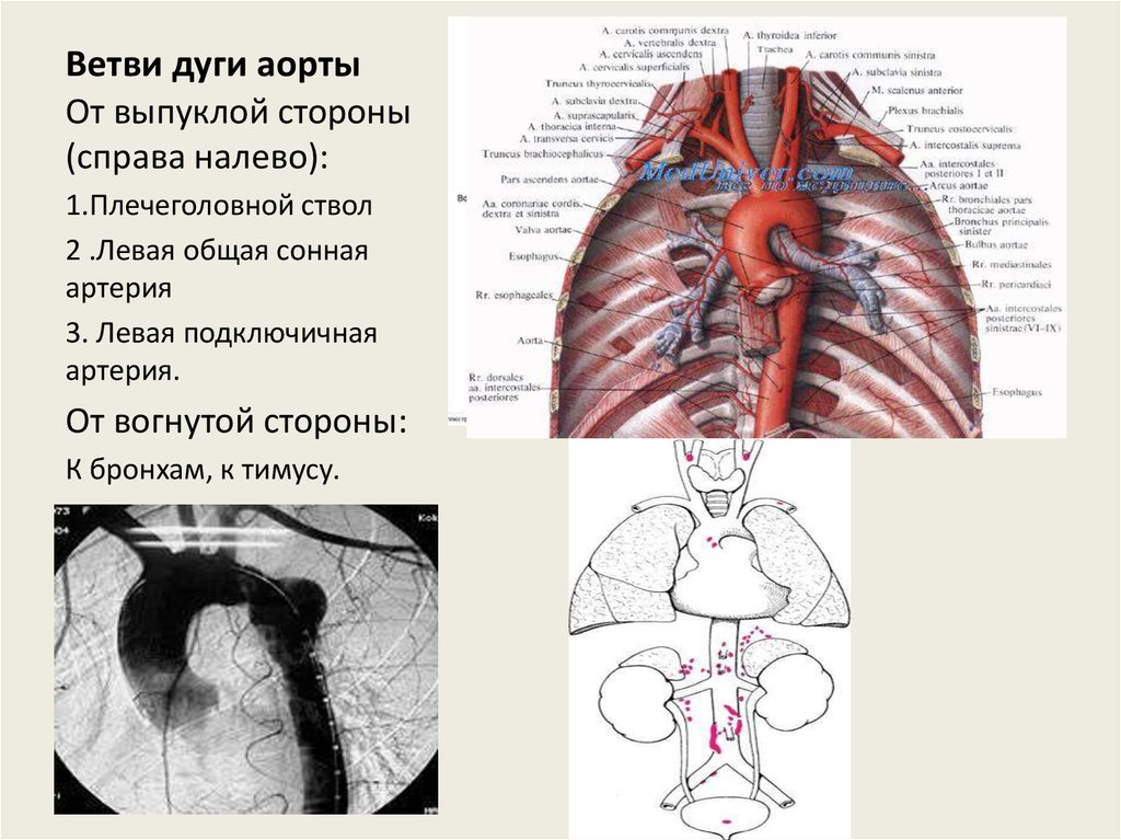 Ветви дуги аорты схема