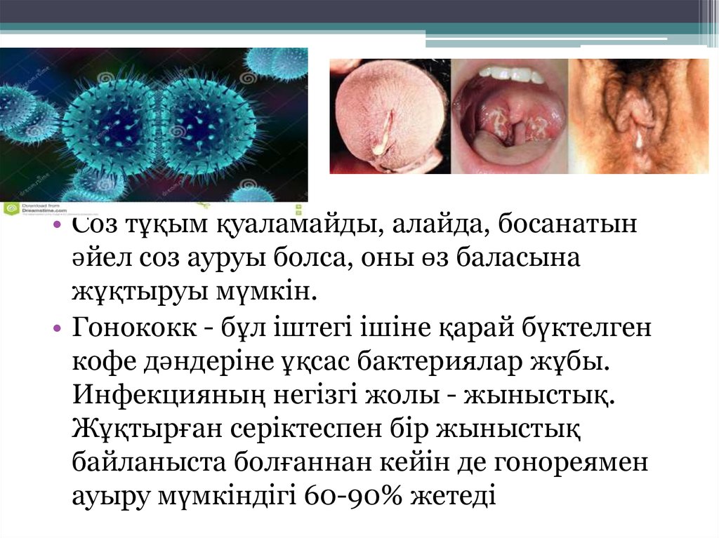 Гонорея картинки для презентации