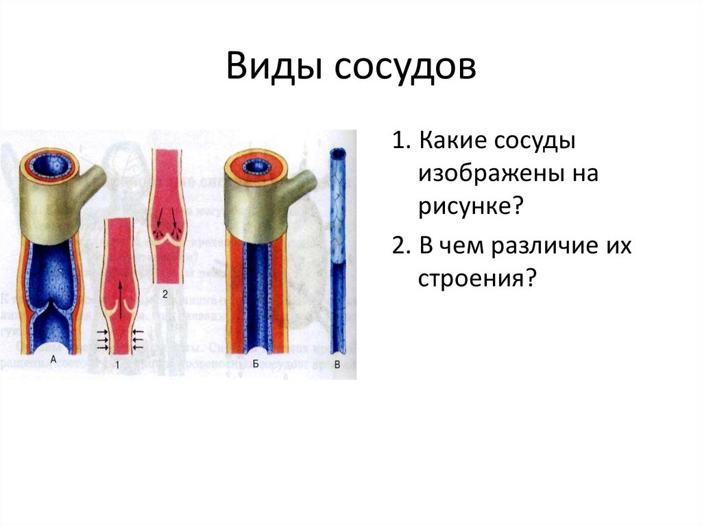 Сосуды какая ткань. Виды сосудов. Виды артерий. Компенсирующие сосуды. Какой сосуд изображён на рисунке.