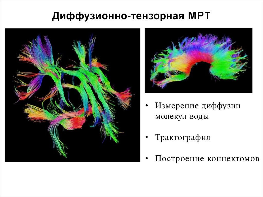 Диффузионно взвешенное изображение