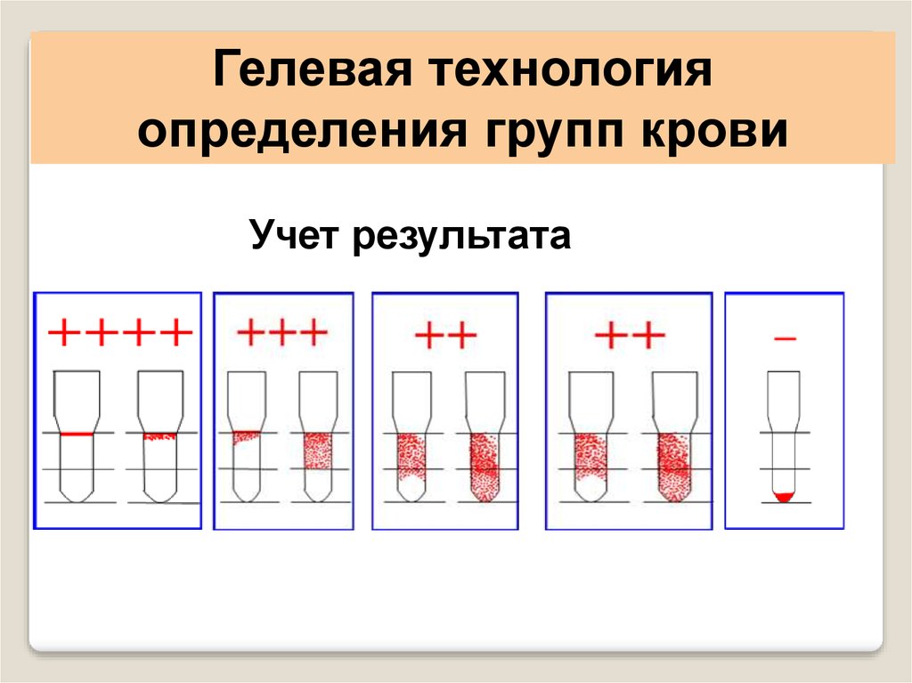 Рассмотрите схему совместимости групп крови