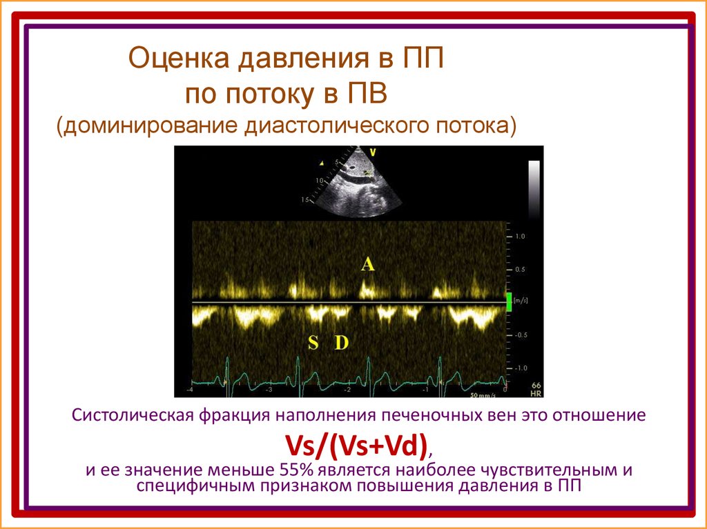 Оценила давление. Как оценить ад.