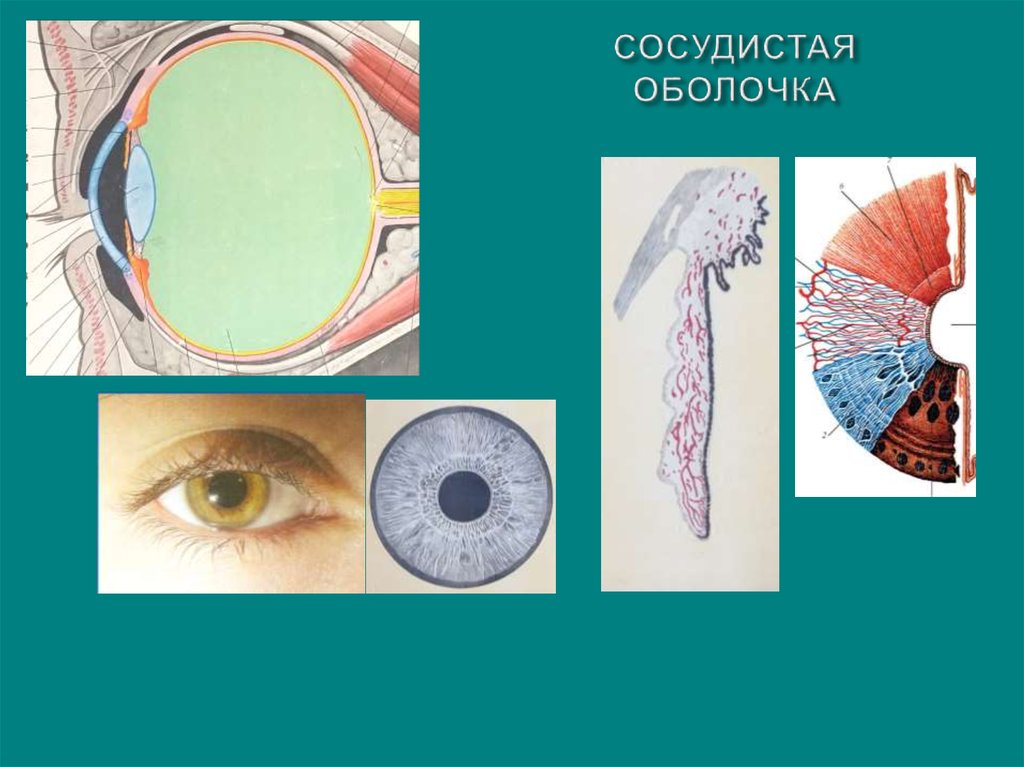 Цвет сосудистой оболочки глаза. Заболевания сосудистой оболочки глаза. Патология сосудистой оболочки глаза презентация. Проводящие среды глаза. Светопреломляющий аппарат глаза.