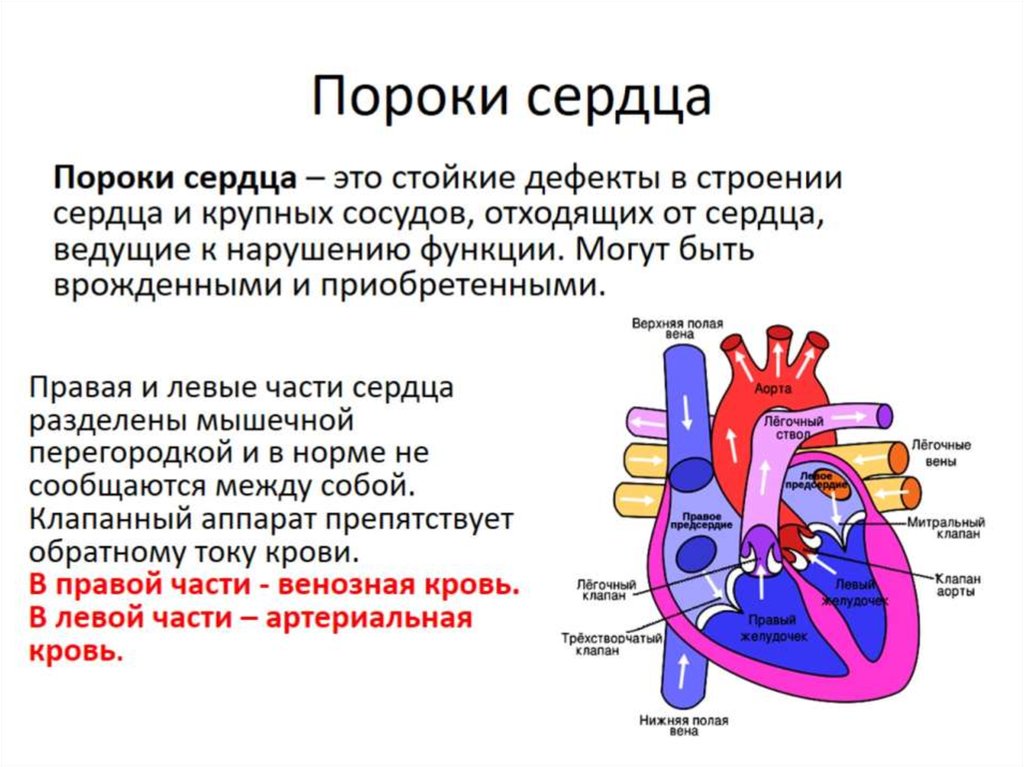 Пороки сердца у детей презентация