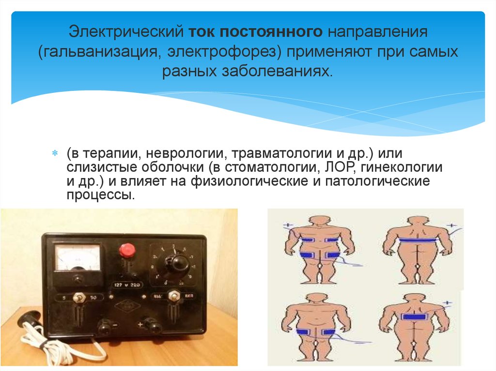 Гальванизация в стоматологии презентация