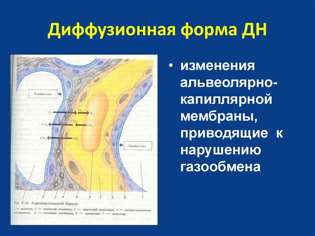 Аэрогематический барьер презентация